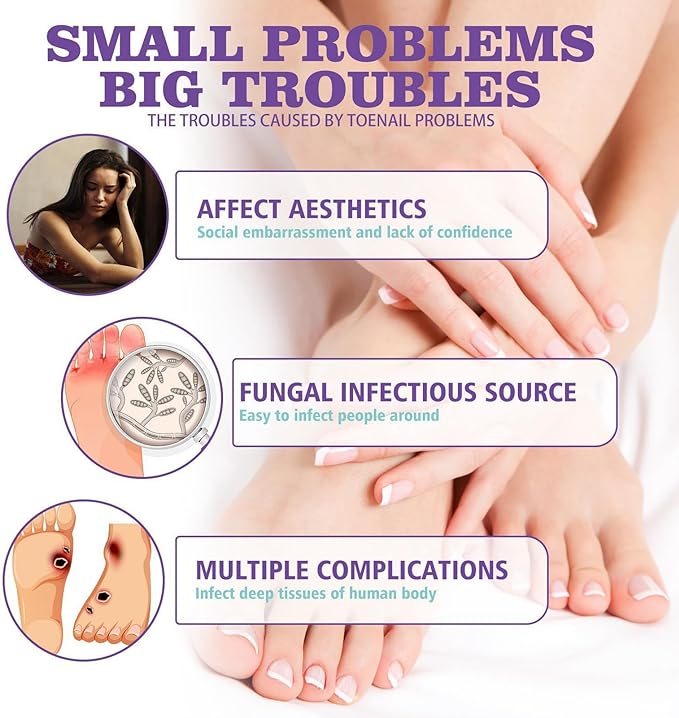 Nail Fungus Spray - Zambeel